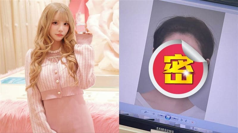 網美遭霸凌怒砸2750萬換臉!宣布拍Netflix「整形過程」真實經歷全說了(新聞配圖)