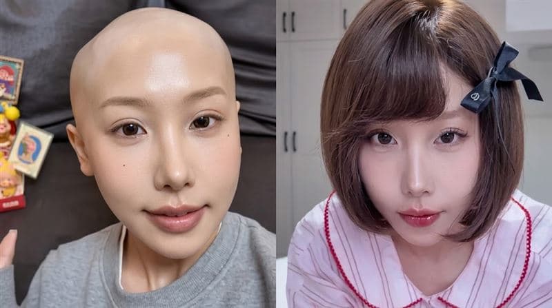 25歲網紅胃癌病逝！生前淚揭「奪命壞習慣」竟成遺言　網一看全嚇傻（新聞配圖）