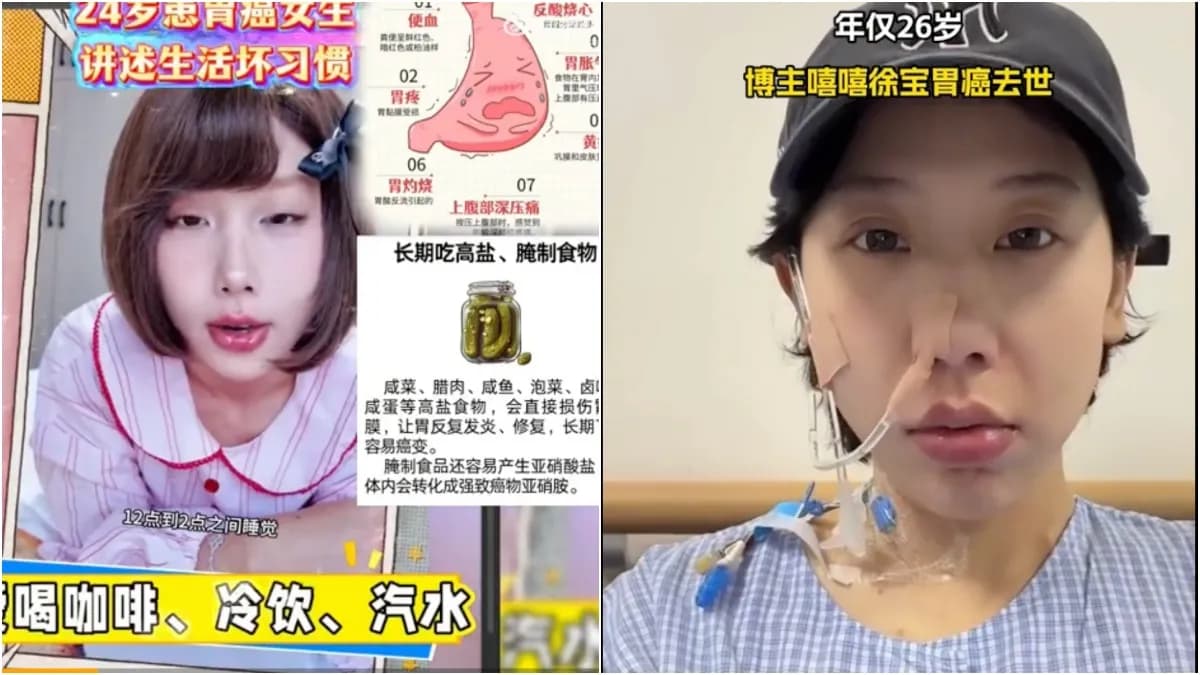癌症（各種癌症預防、治療、飲食、名人癌症）-健康2.0（新聞配圖）