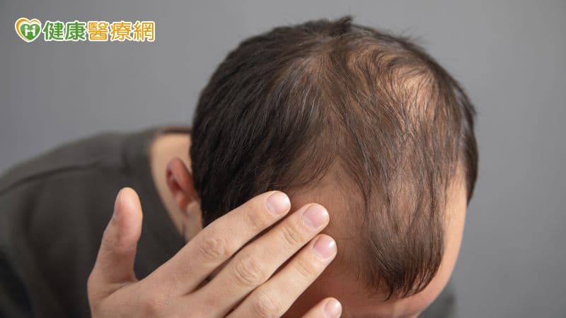 37歲男頭髮愈來愈少以為雄性禿!抽血揪「真正原因」 竟是缺這營養素(新聞配圖)