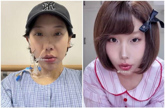 25歲博主罹胃癌病逝！生前自述「不良生活習慣」引熱議（新聞配圖）