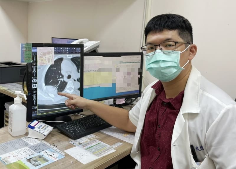 久咳不癒卻精神好到能上班 CT驚見肺部「白月樹影」(新聞配圖)