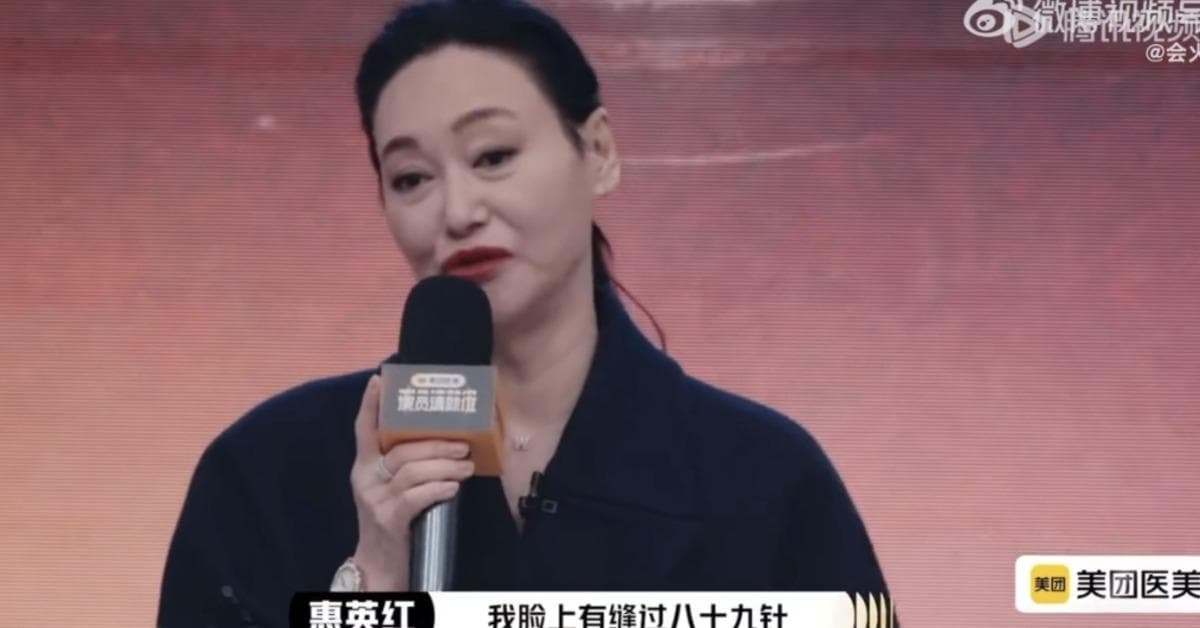 惠英紅驚傳巴黎被搶!網路曝光遇劫悽慘照 車窗被砸、包被搶(新聞配圖)