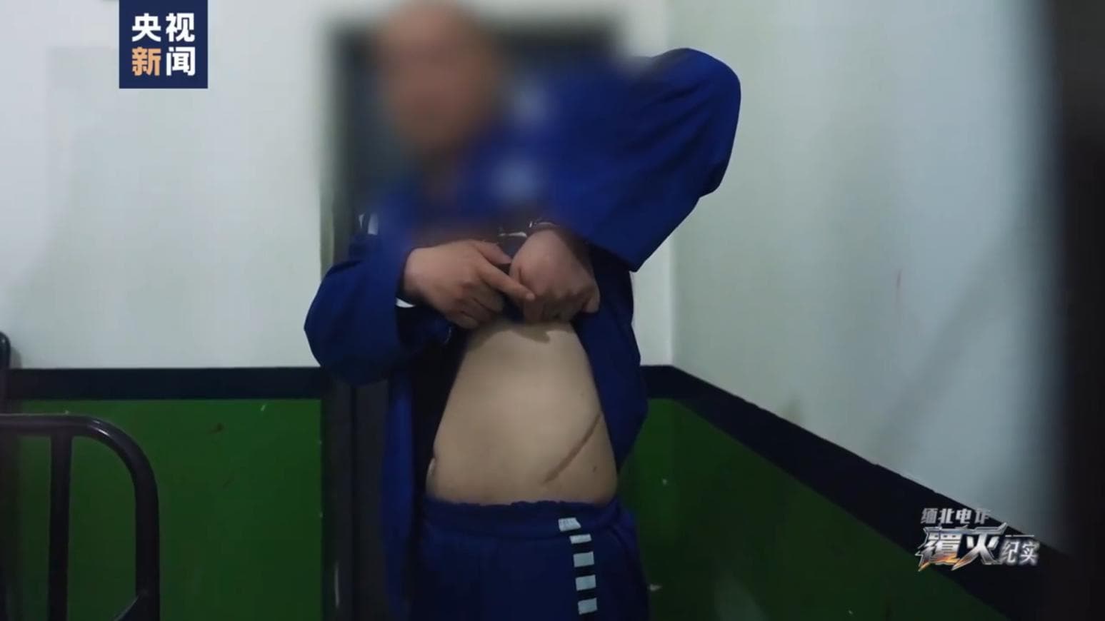 緬北詐騙黑幕曝!陸男遭毆打「賣腎抵債」 紀錄片揭人間煉獄(新聞配圖)