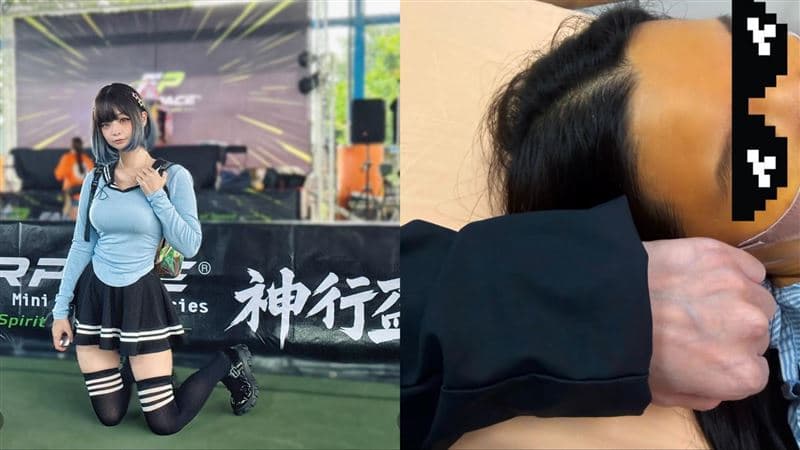 聽信偏方惹禍!郭鬼鬼母送急診插管 「早晚吃5顆黃連」肝指數狂飆(新聞配圖)