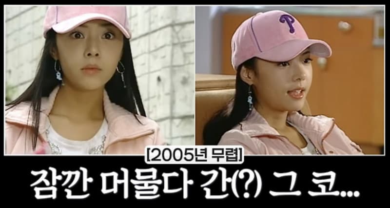 韓「戲劇女王」認整形做太多「把漂亮臉弄壞」修復費暴增10倍(新聞配圖)
